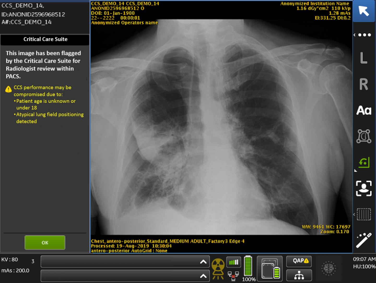 GE Healthcare's Critical Care Suite