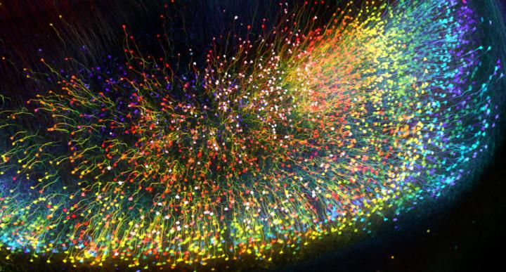 Novel Techniques for 3D Visualization of Microscopic Structures in the Human Brain