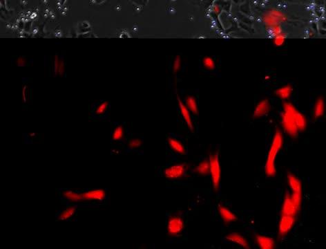 Dual Action Virus Killing Cancer Cells and Fibroblasts