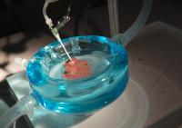 Liver in Machine Perfusion System