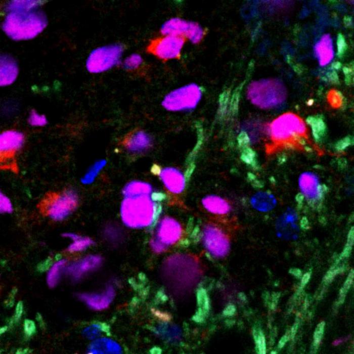 transplanted stem cells