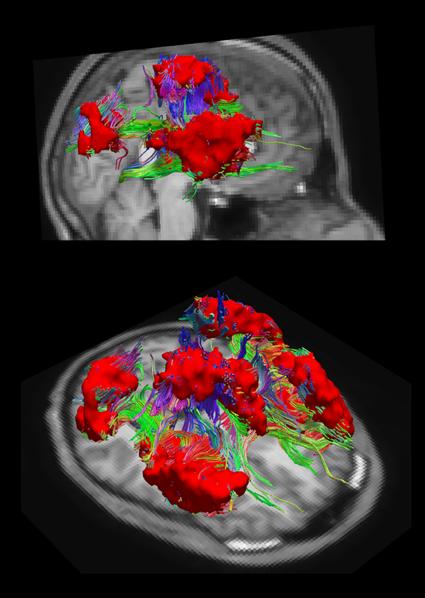 New Brain Atlas