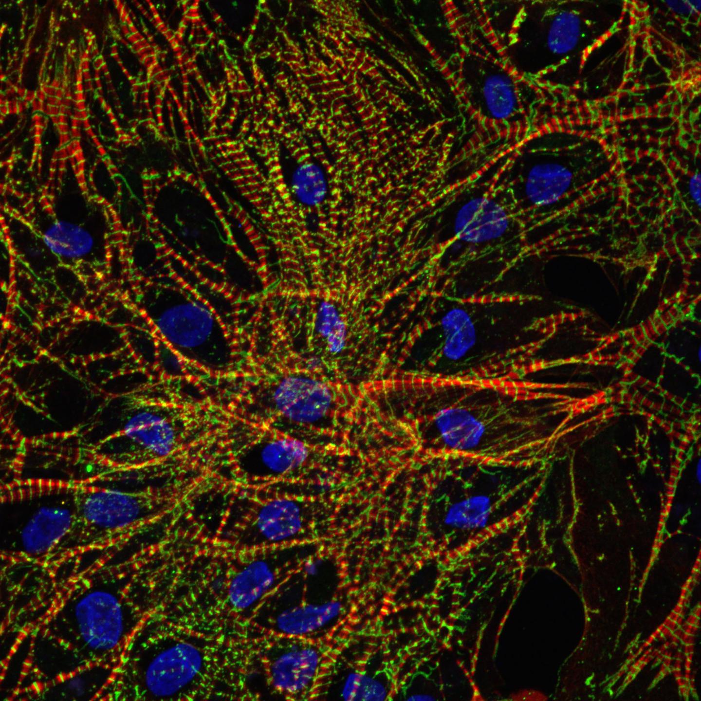 Immunofluorescence Imaging of hiPSC-Derived Cardiomyocytes Grown in Microgravity Aboard the ISS