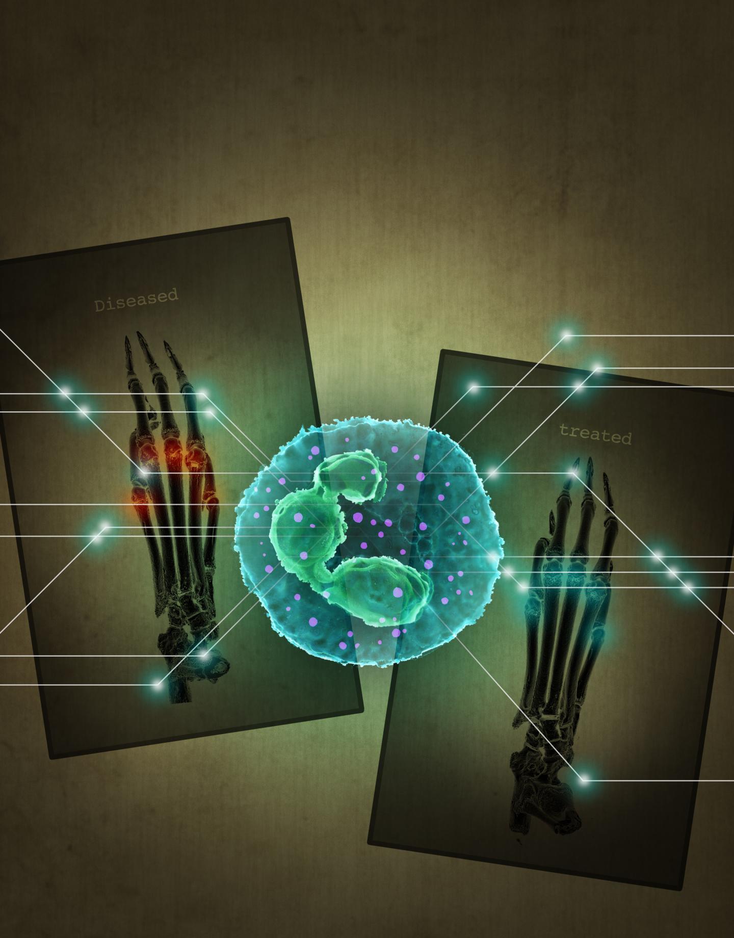 Newly Discovered Inflammatory Pathway Offers Safer Therapeutic Target (1 of 1)