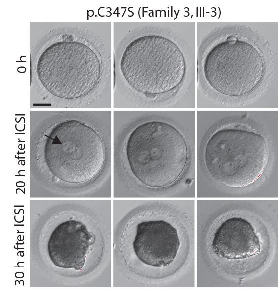 Study Reveals the Genetic Origins of an Inherited Form of Female Infertility (1 of 1)
