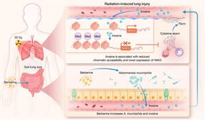 Berberine protects against radiation-induced lung injury through the gut–lung axis