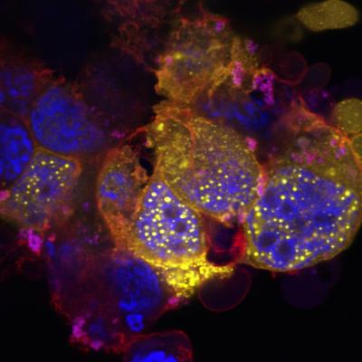 Sphere Structures in the Cell Nucleus
