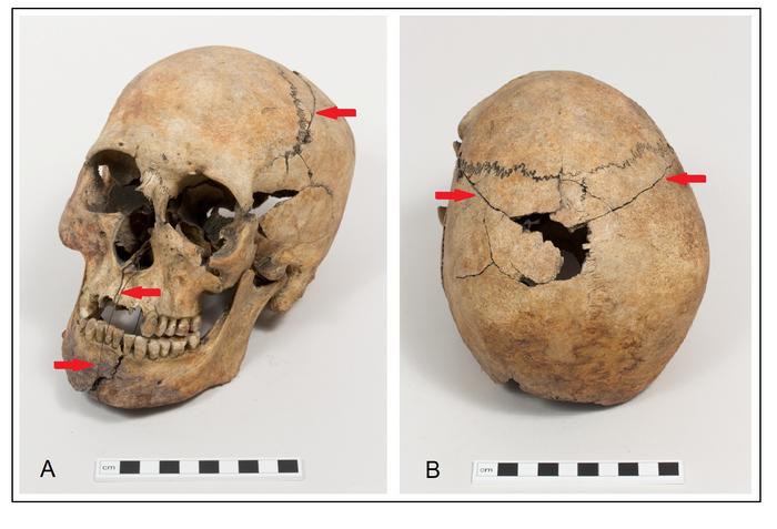 Skeleton skull
