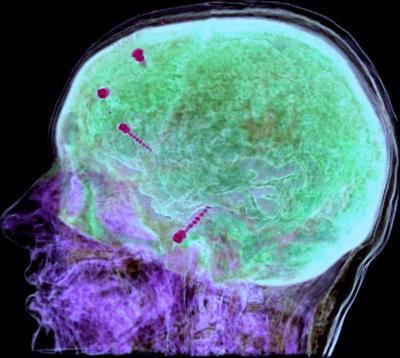 From Thought to Speech in 600 Milliseconds (2 of 4)