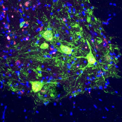 Stem Cells Offer Hope for Spinal Muscular Atrophy