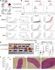 Tumoral B7x enhances bladder tumor growth in an immunocompetent host