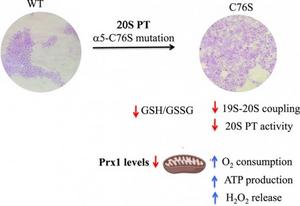 New model enables the study of how protein complex influences mitochondrial function