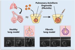 A “breathing” lung organoid enables measurement of lung stiffness