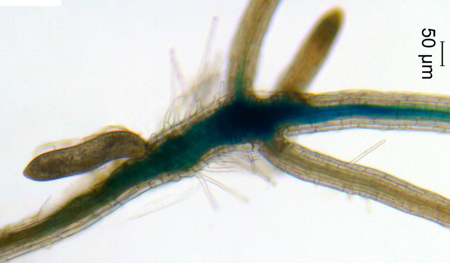 Nematode Feeding Site