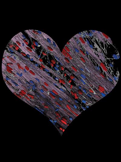 A Change of Heart
