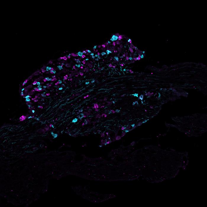 Section of a mouse dorsal root ganglion with two subtypes of pain receptors marked in cyan and magenta.