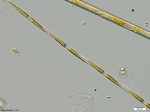 Pseudo-nitzschia
