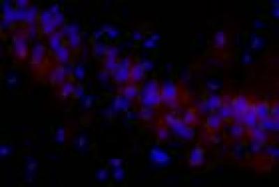 Microtubules 