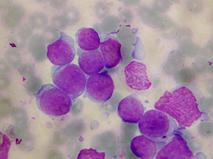 ALL Cells