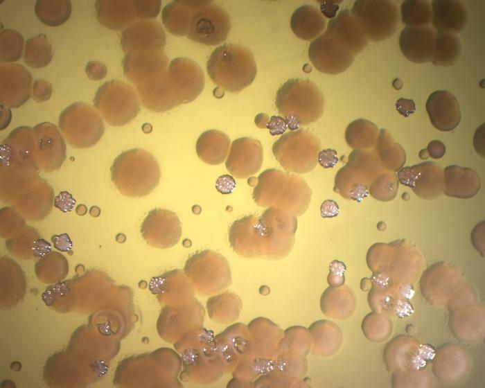Pseudomonas aeruginosa bacterial colonies