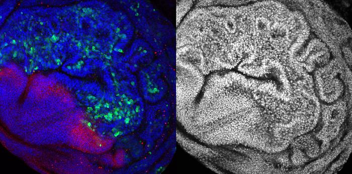 Chromosomal Instability induced epithelial tumor