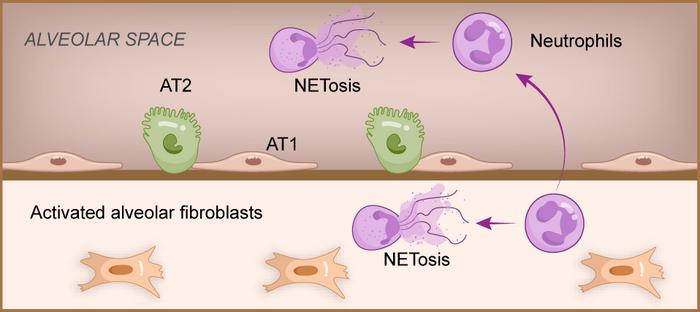 Alveolar Fibroblasts Respond to Pseudomonas Aeruginosa Infection with Cytokine Secretion: Role in Acute Lung Inflammation