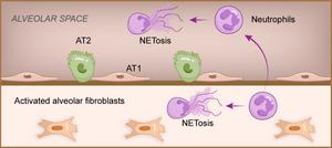 Alveolar Fibroblasts Respond to Pseudomonas Aeruginosa Infection with Cytokine Secretion: Role in Acute Lung Inflammation