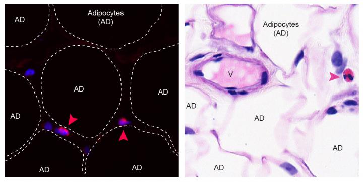 Eosinophils in Human Visceral Adipose Tissue