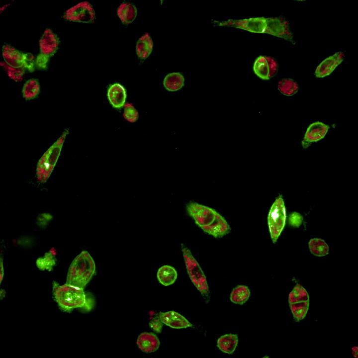 Mesenchymal cells