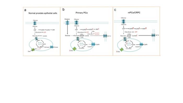 Schematic representation of metabolic reprogramming in prostate epithelial cells during various stages of cancer progression.