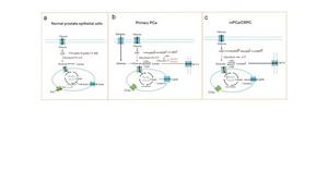 Schematic representation of metabolic reprogramming in prostate epithelial cells during various stages of cancer progression.