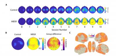 Alpha Power Difference in Meditation and Control Groups