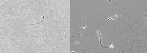 Mouse Sperm