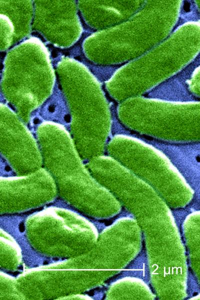 <i>Vibrio vulnificus</i> Bacteria