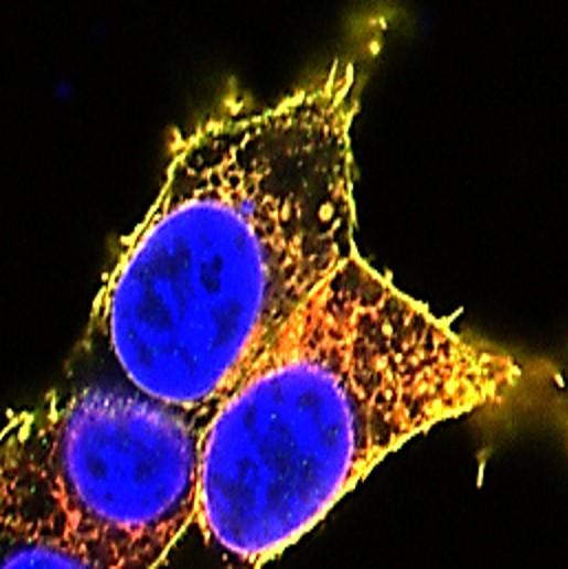 Caron Cells