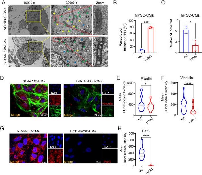 LVNC-hiPSC-CMs have abnormal skeleton, polarity, and mitochondria compared with the NC-hiPSC-CMs.