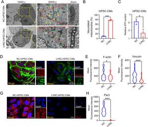 LVNC-hiPSC-CMs have abnormal skeleton, polarity, and mitochondria compared with the NC-hiPSC-CMs.