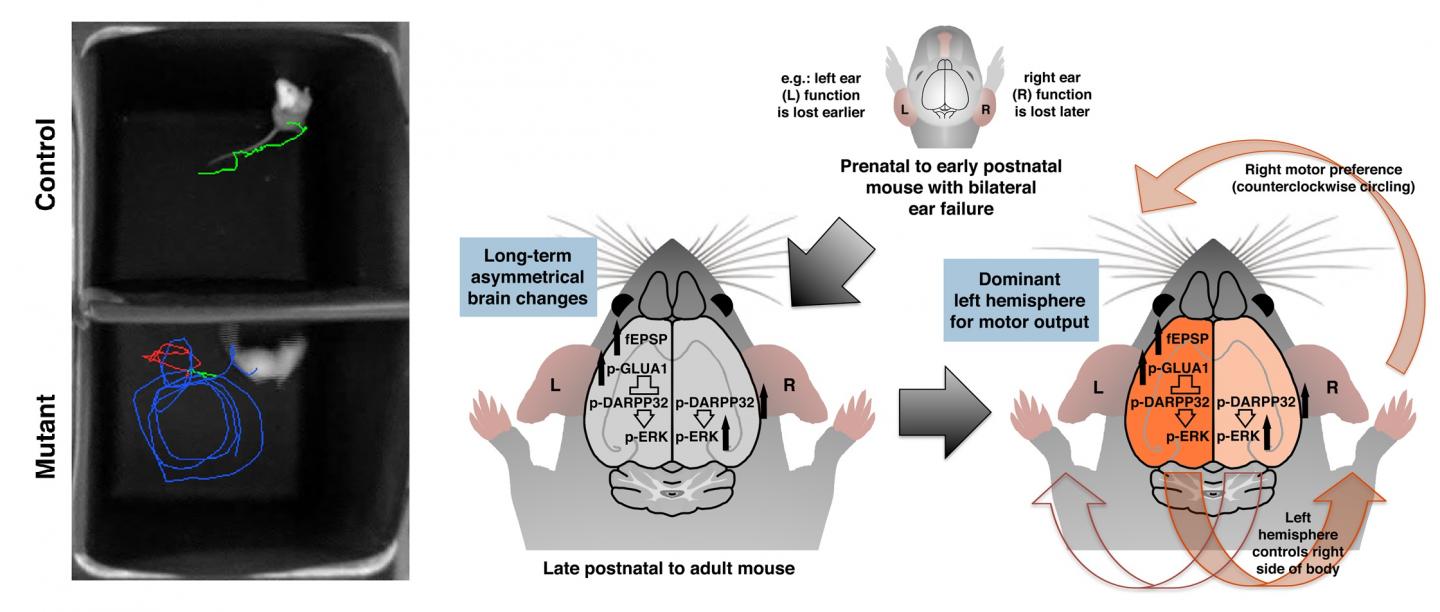 Lopsided Ear Function Can Lead to Lopsided Brain Development