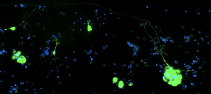 Co-culture of human neurons and epithelial cells. Cells infected with SARS-CoV-2 are stained green. Several infected neurons are visible. Cell nuclei are shown in blue.