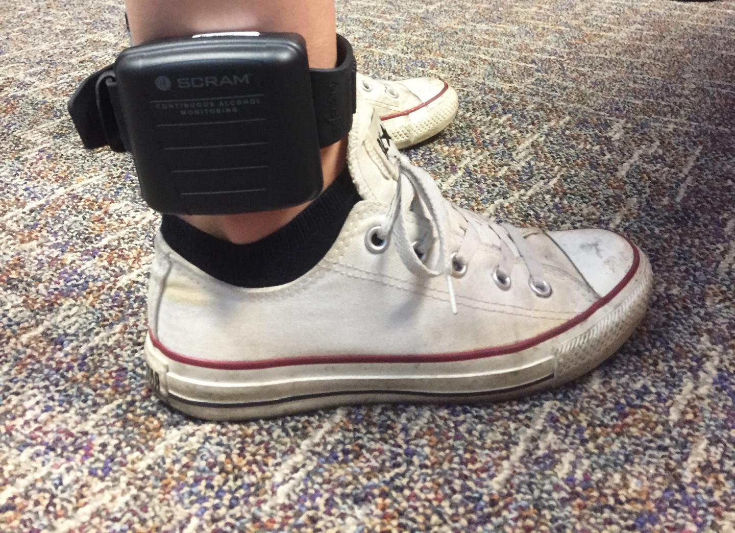 Student being Fitted with Trans-Dermal Blood Alcohol Monitor