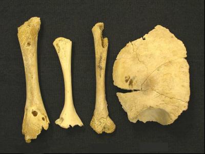 Searching for Ancient Syphilis DNA