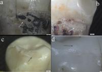 Irregular Facets of Neanderthal Teeth