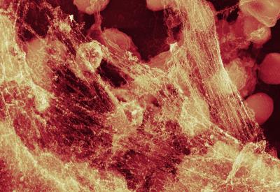 White Blood Cells and NETs