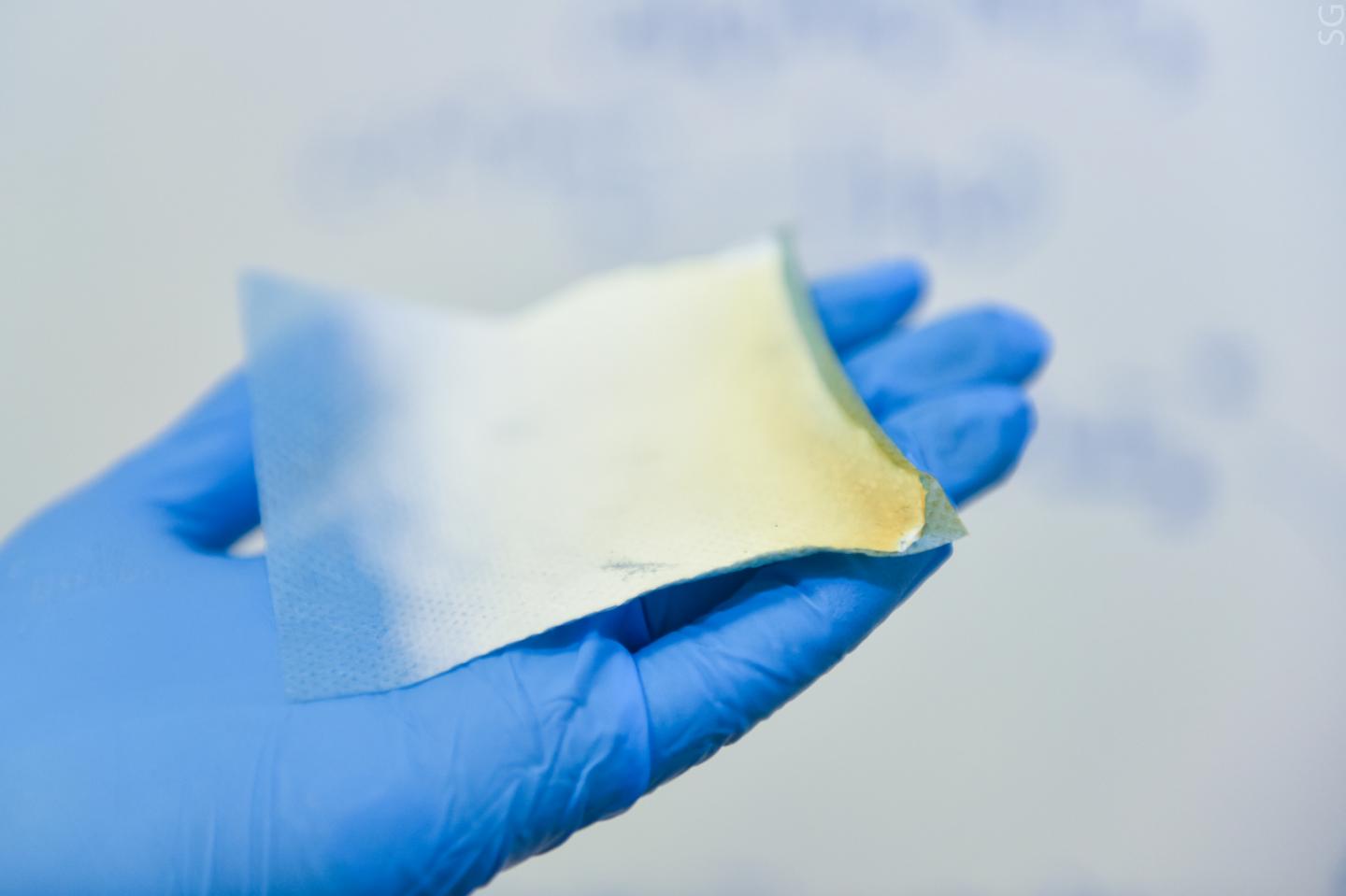 New Therapeutic Material Based On Nanofibers Made of Polycaprolactone