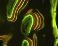 Better Drug for Treating Muscle, Bone Loss in Elderly Men
