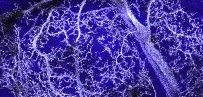 Silver-Labeled Dendrites