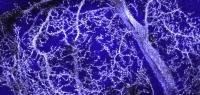 Silver-Labeled Dendrites