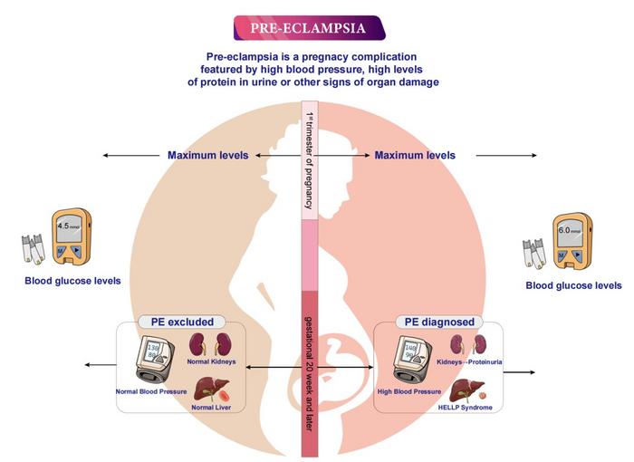 Gestational blood glucose levels and pre-eclampsia risk across pregnancy trimesters