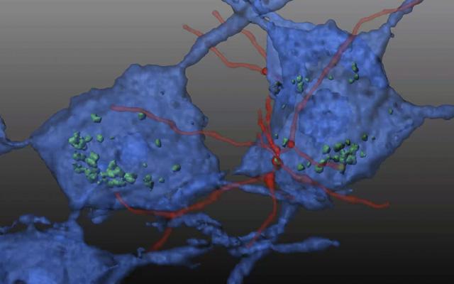 Friedreich's Ataxia Model, University of California San Diego School of Medicine