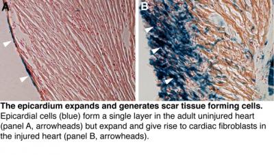 Uninjured and Injured Epicardium